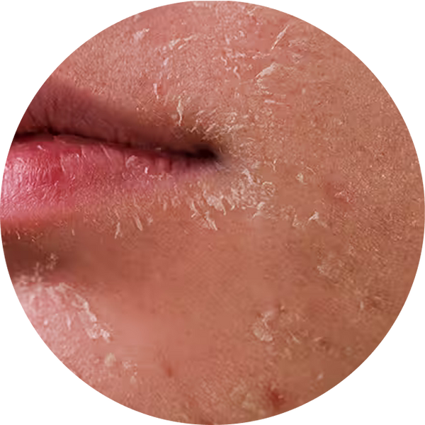 Barrier Repair & Hydration