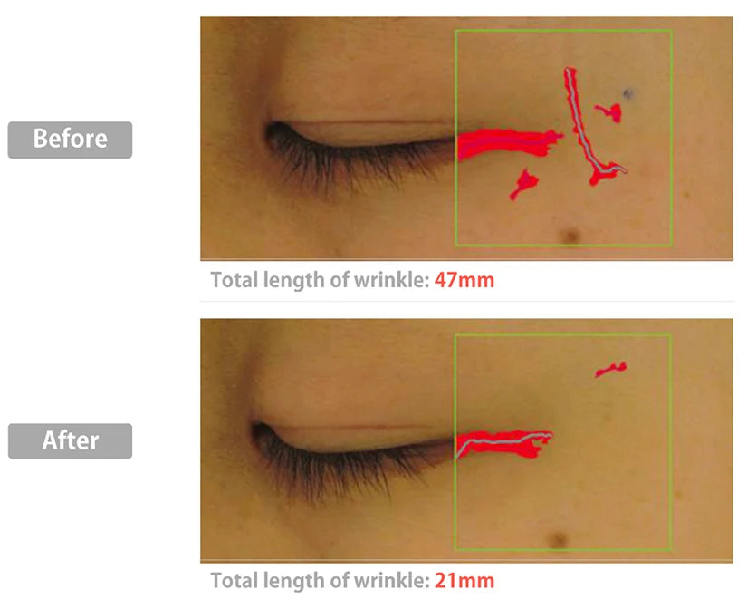 Skin analysis layout chart