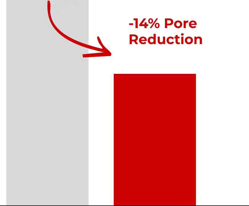 Reduction in appearance of pores by*